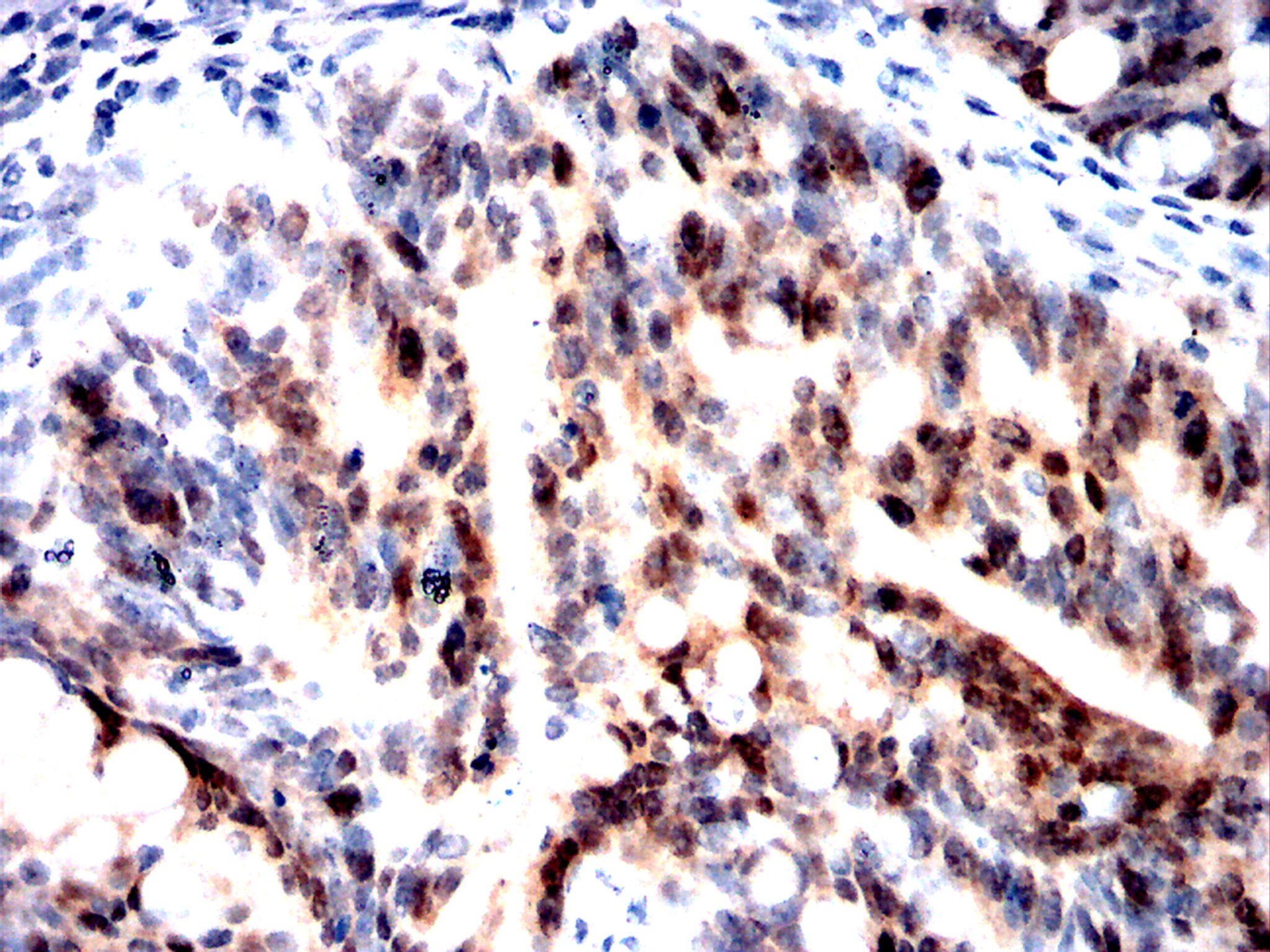 IHC